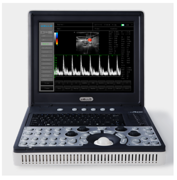 便携式全数字彩色多普勒超声诊断系统d3.