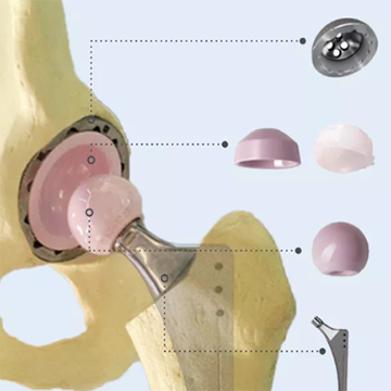 双动髋关节系统or3o dual mobility system