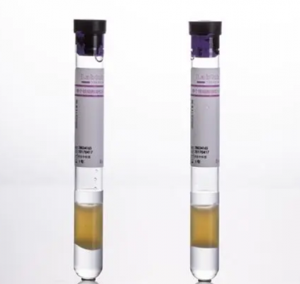 一次性使用离心杯式血细胞回收器hsq-g1