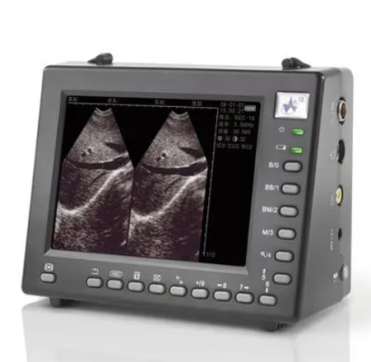 无线掌上彩色多普勒超声诊断仪mu-9p