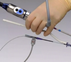 鼻窦球囊导管sbc0624