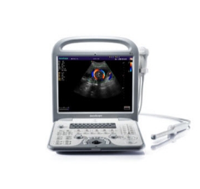 无线掌上彩色多普勒超声诊断仪kcu-h72s