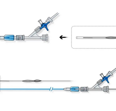 吉诺斯血栓抽吸导管gac-8-150