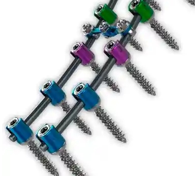 威高脊柱后路内固定系统组件