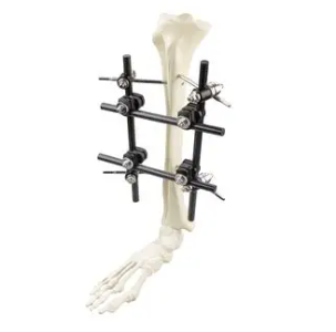 组合式外固定支架kw3型