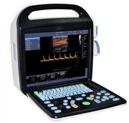 便携式彩色多普勒超声诊断仪