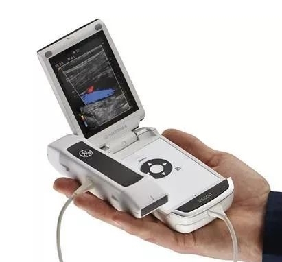 无线掌上彩色多普勒超声诊断仪
