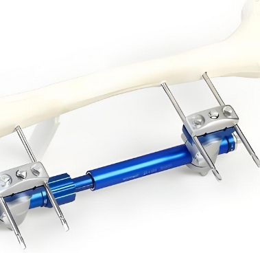 泰瑞博思医用外固定支具