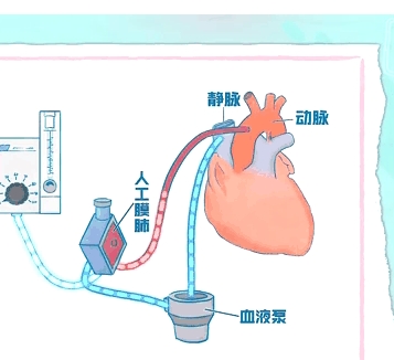 动态心肺音数据存储传输软件ld-hls理得