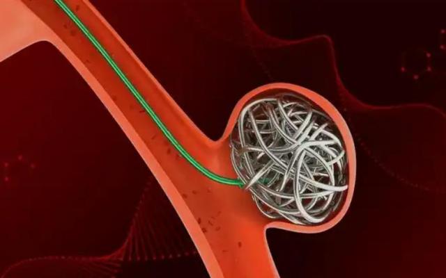 jh-mc21150str 神经血管微导管 厂家