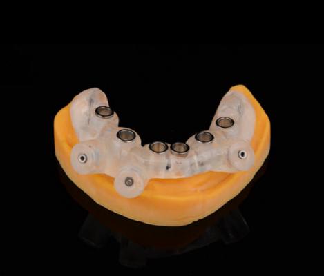 定制式牙科种植导板 厂家