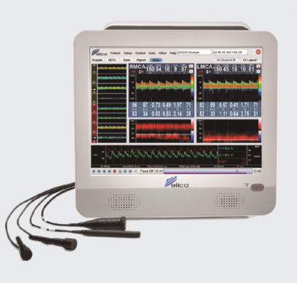 ems—9k超声经颅多普勒血流分析仪代理