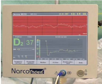 美添脑电意识深度监测仪narcotrend-compact